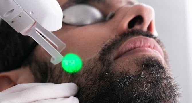 épilation laser maison lutétia