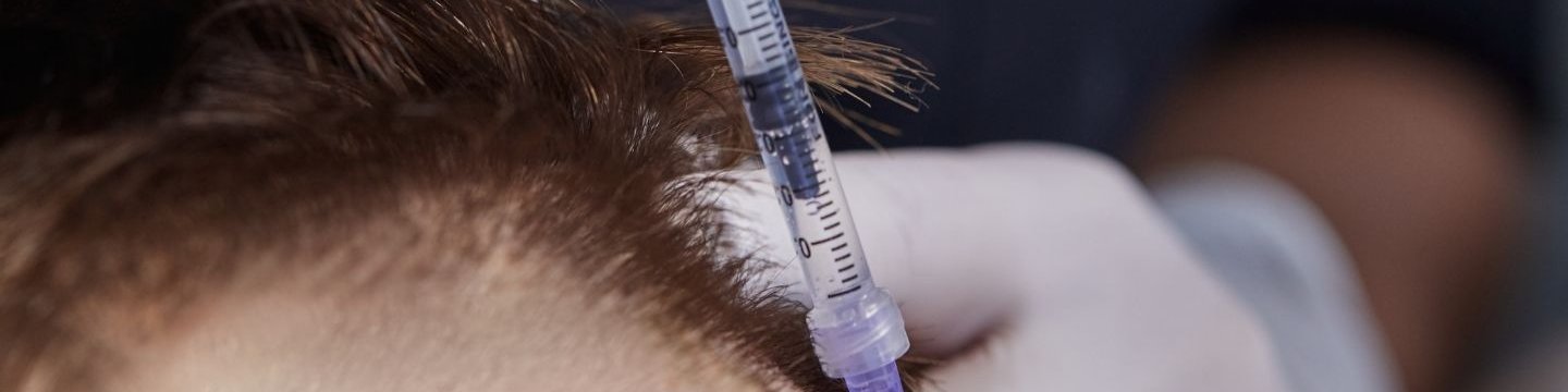 bandeau injection anesthésie locale lors de greffe de cheveux