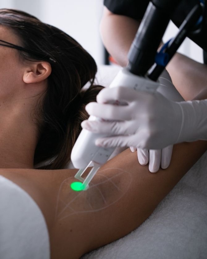 Séance d'épilation laser à la Maison Lutétia, utilisant un faisceau lumineux pour détruire les follicules pileux