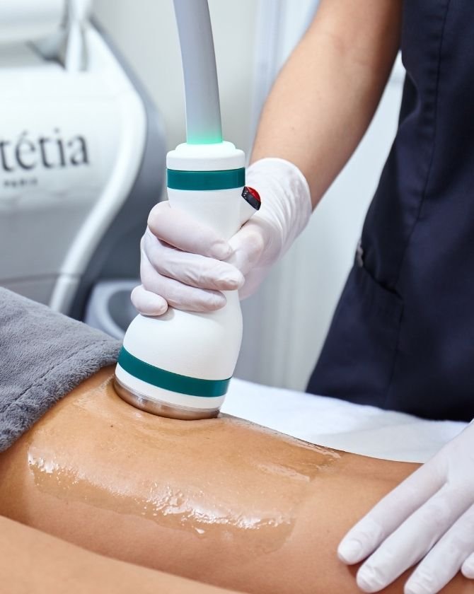 Séance de BodyLift combinant radiofréquence et micro-ondes intelligentes pour remodeler la silhouette