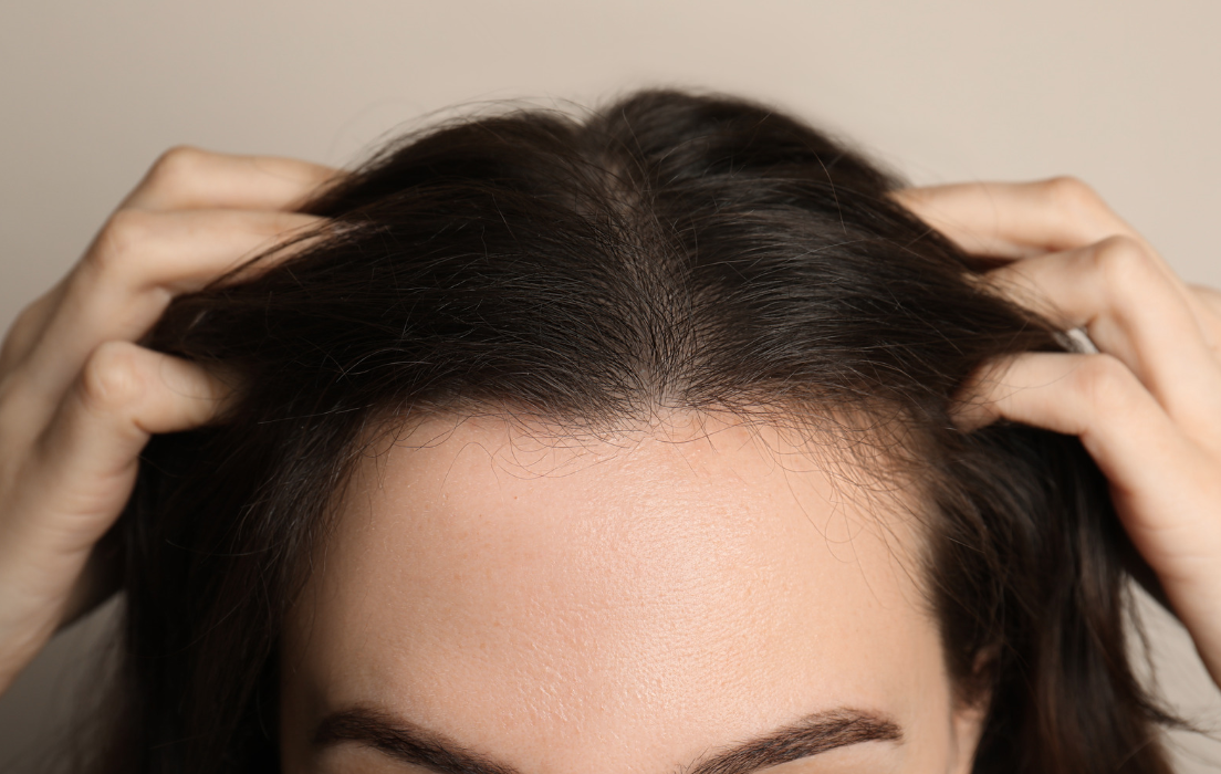 Pourquoi survient une alopécie diffuse