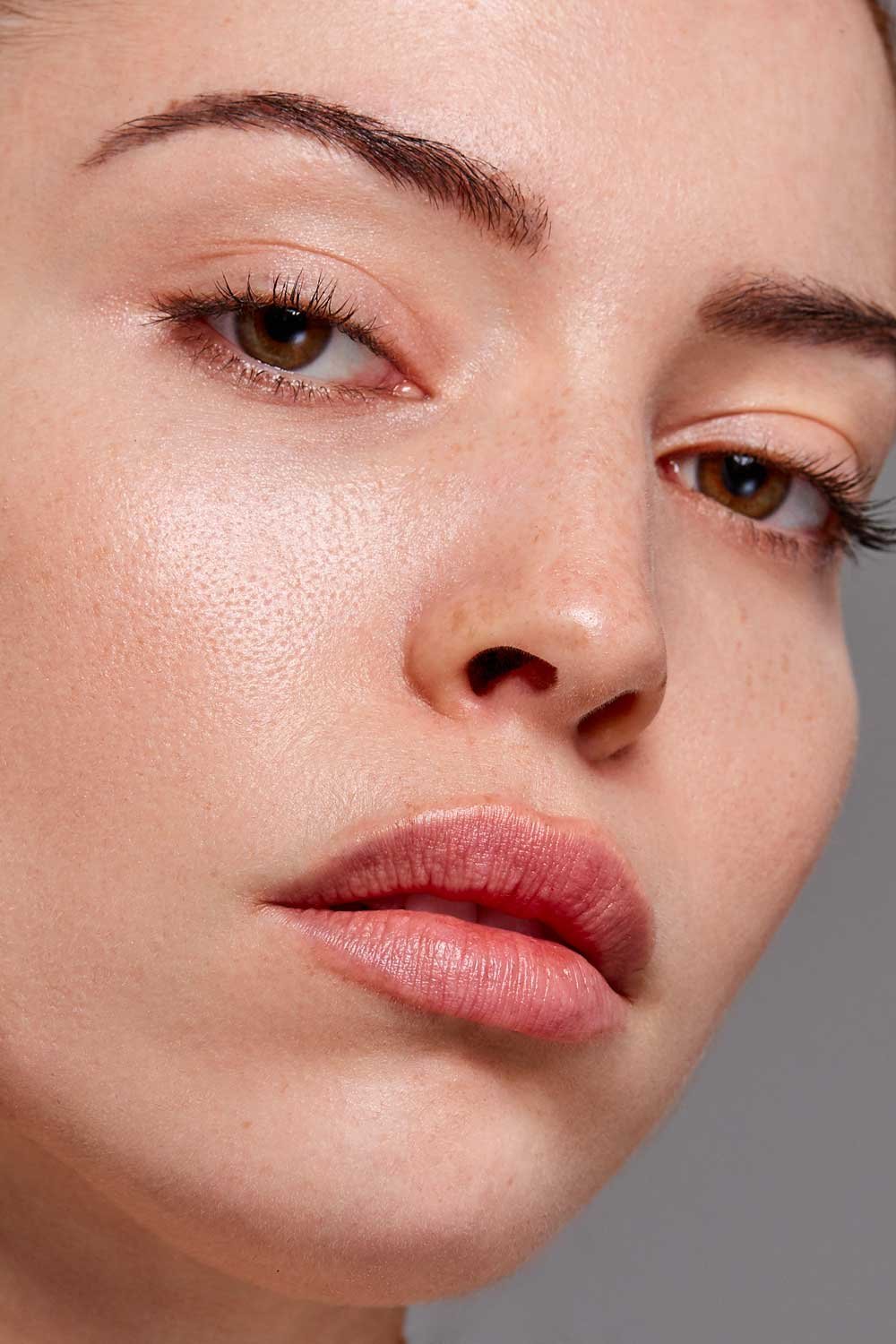 Injection de Botox® dans le muscle de la lèvre supérieure pour un effet Lip Flip