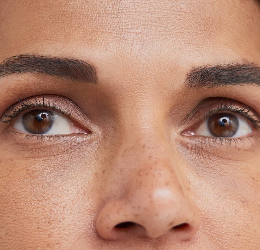 traitement contre la perte de sourcils paris
