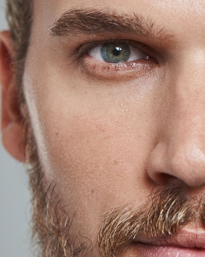 traitements pour se débarrasser des pores dilatés