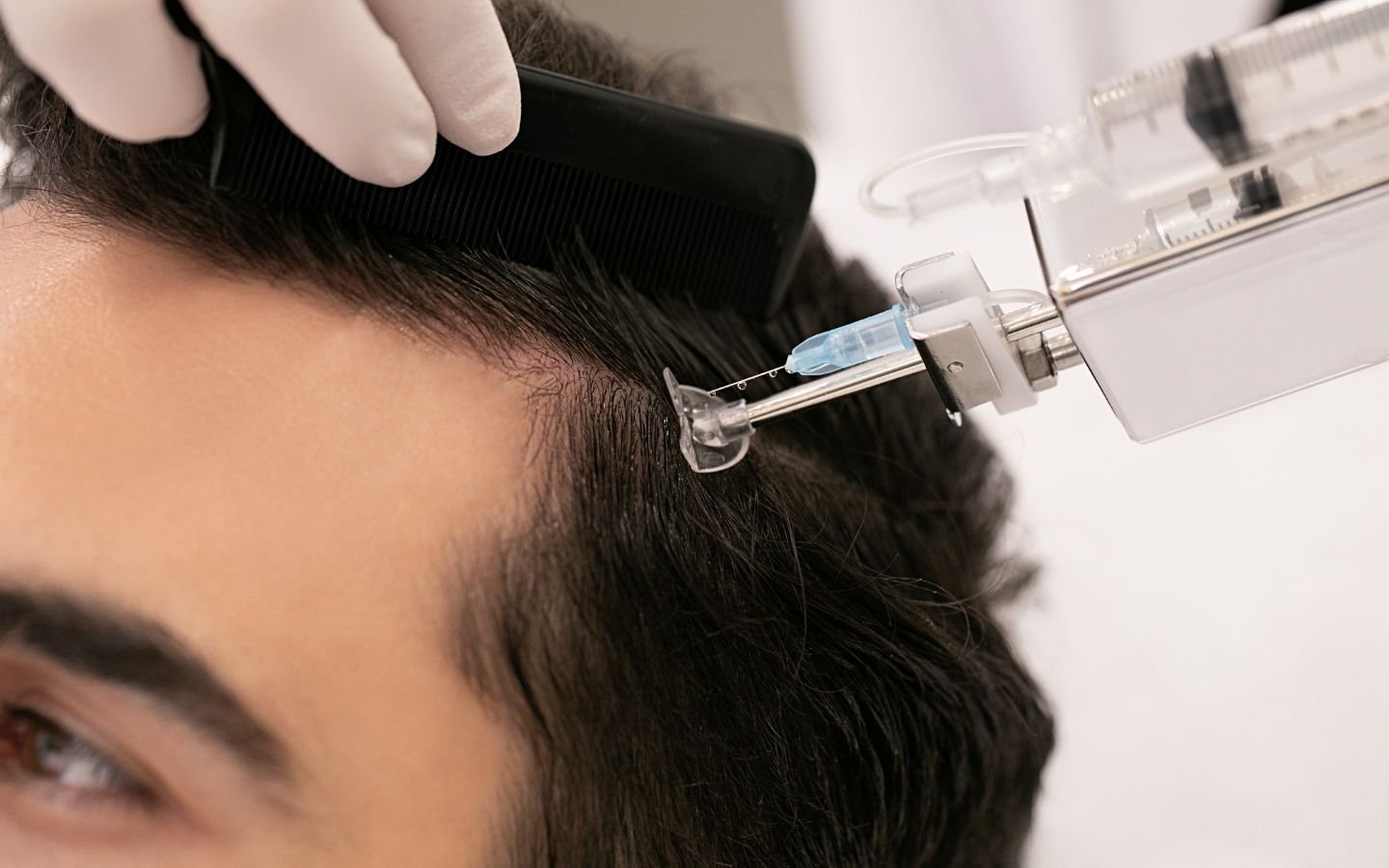 MésoLED® capillaire – stimulation folliculaire