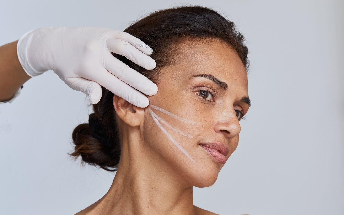 illustration fils tenseurs du visage