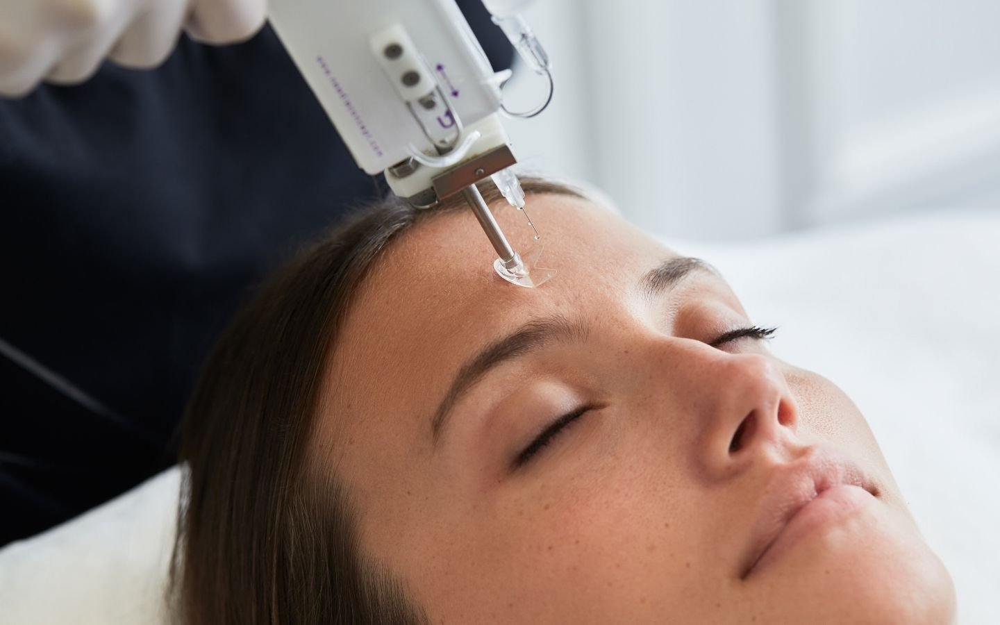 mesotherapie du visage