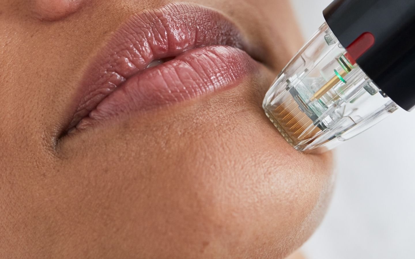 indications en médecine esthétique