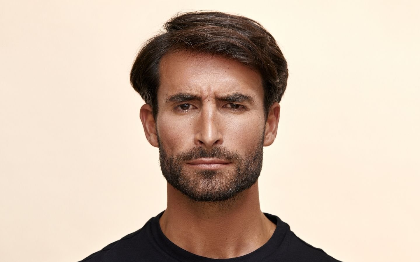 correction de barbe incomplète