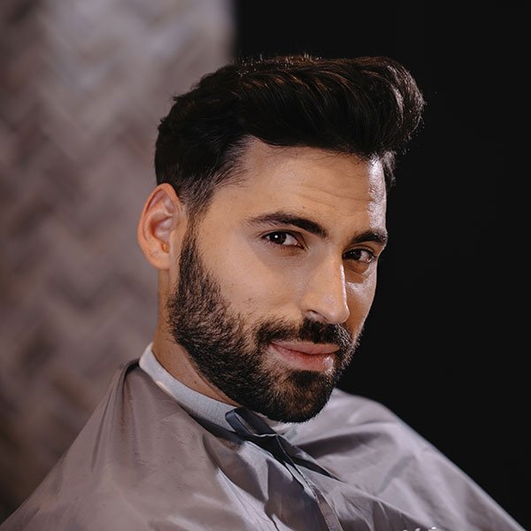 résultat greffe de cheveux DHI