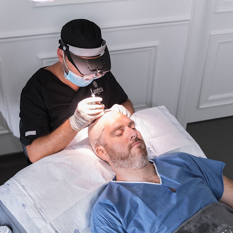 implantation des follicules