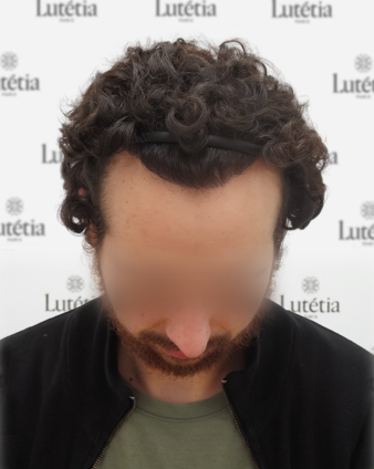 After
