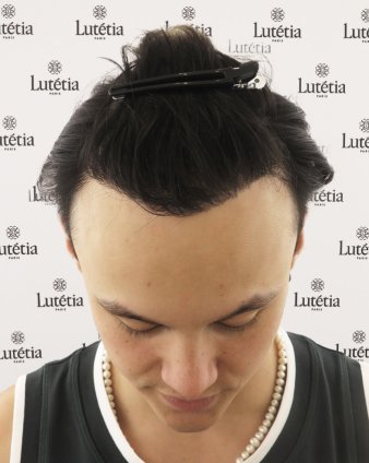 After