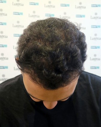  After
