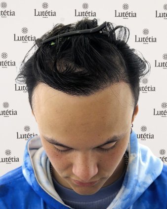 Before