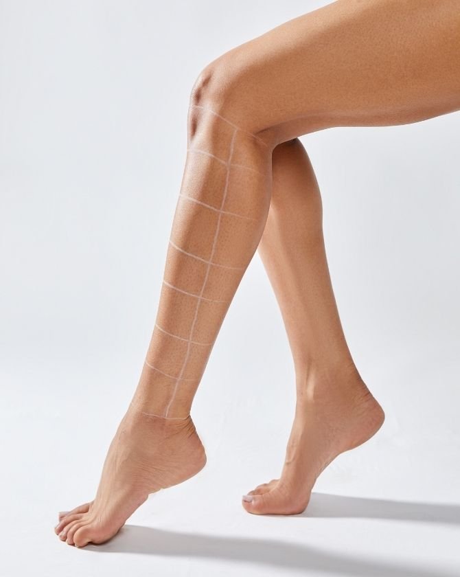 Résultat visible d'une peau plus lisse après plusieurs séances d'épilation laser