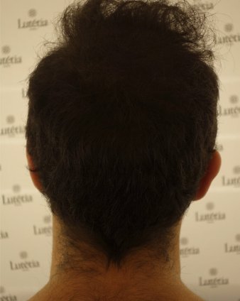  After