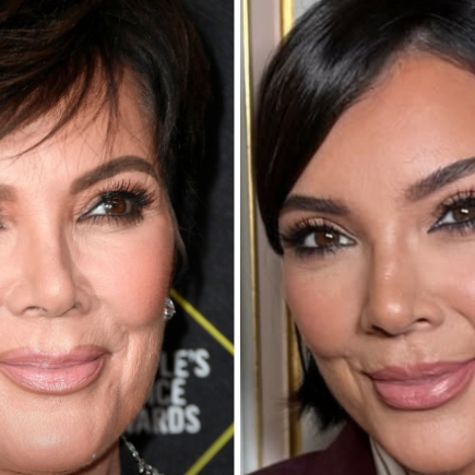 Chirurgie, médecine esthétique… Qu’est-il arrivé au visage de Kris Jenner