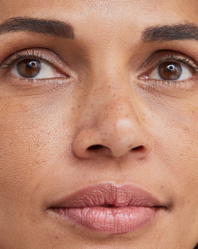 microneedling sur le visage
