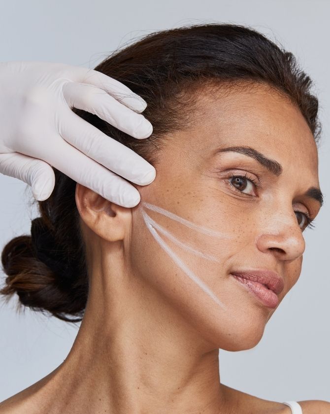 remodelage ovale visage par fil tenseur