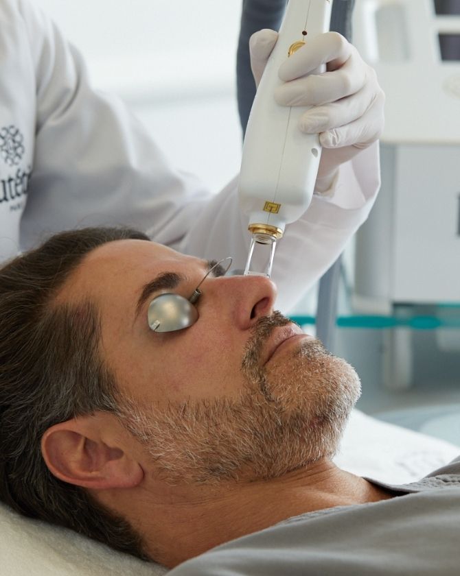 homme recevant un traitement par laser resurfaçant chez la maison lutetia
