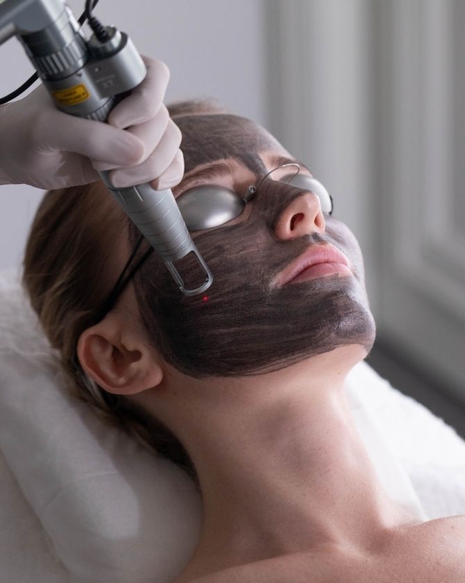 traitement de visage féminin au carbon laser peel