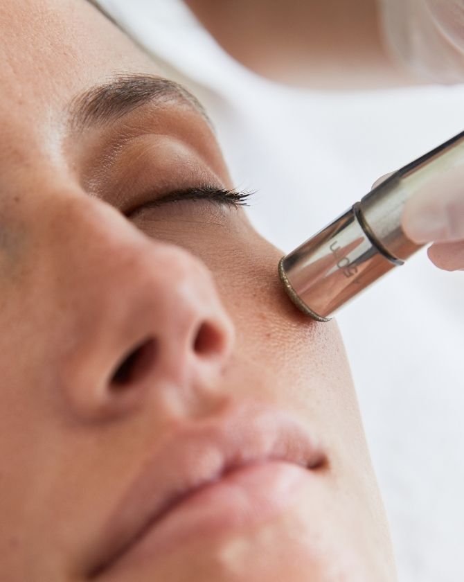 la microdermabrasion contre les imperfections de la peau du visage 