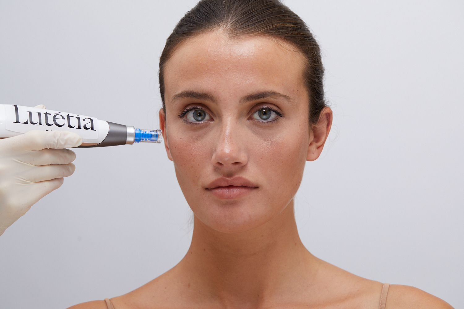 Application du microneedling médical sur une patiente pour traiter la texture granuleuse de la peau.