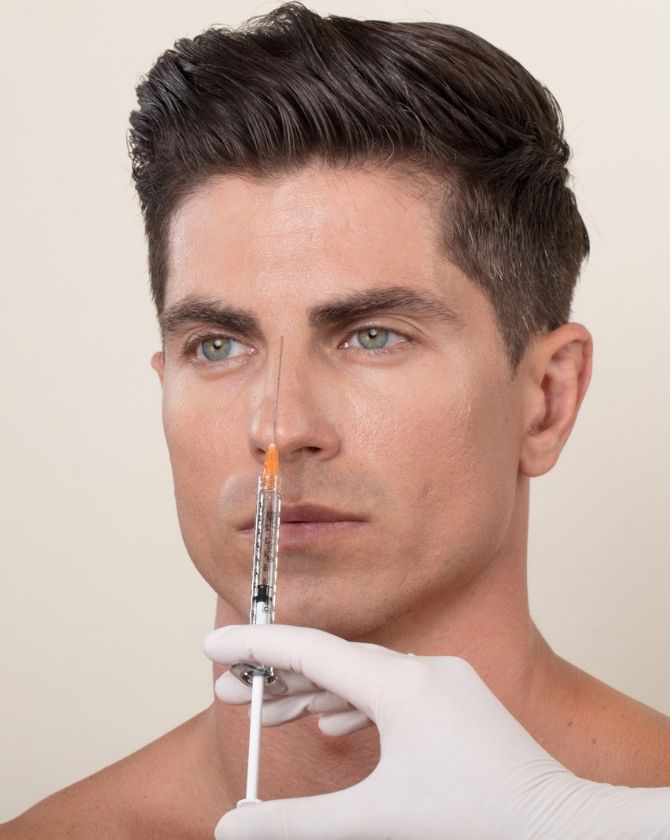 rhinoplastie médicale acide hyaluronique 