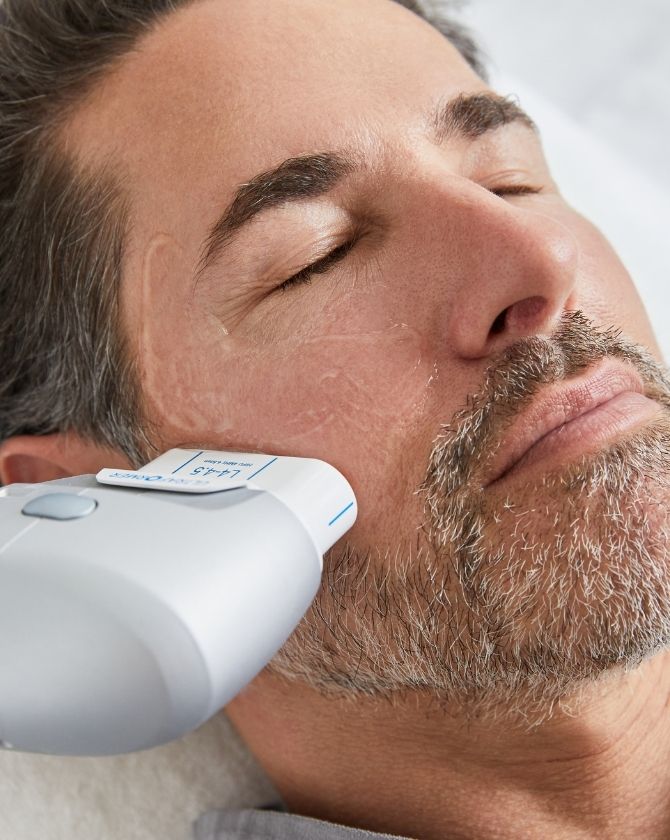 traitement softlift sur visage homme