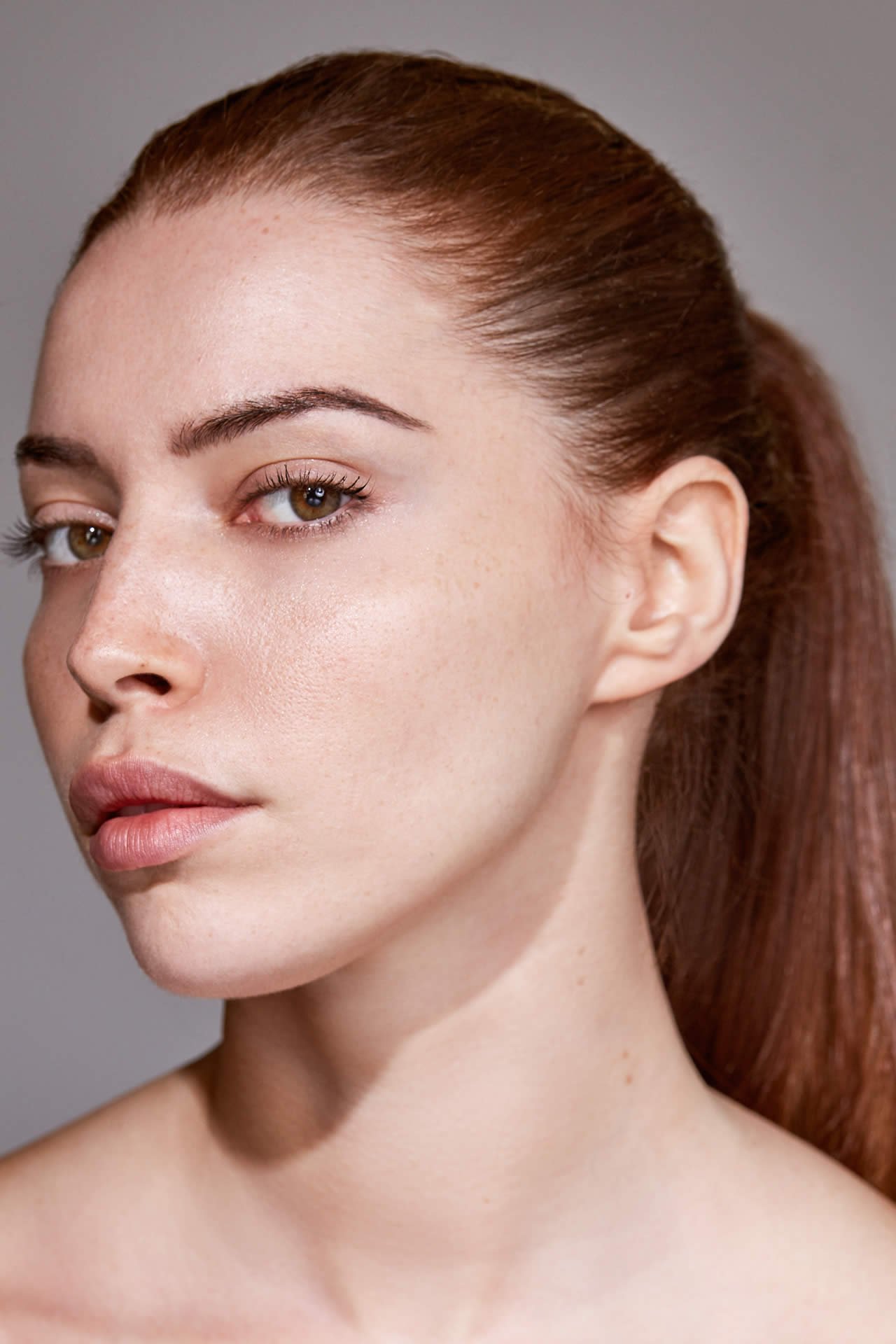 causes principales de l’hyperpigmentation cutanée