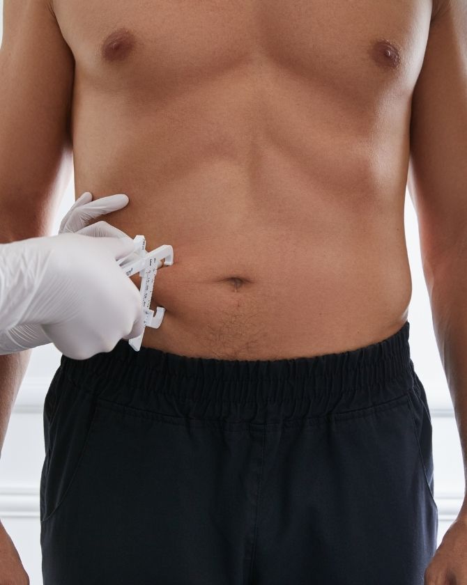 Résultat visible d'une réduction de la cellulite après plusieurs séances de BodyLift
