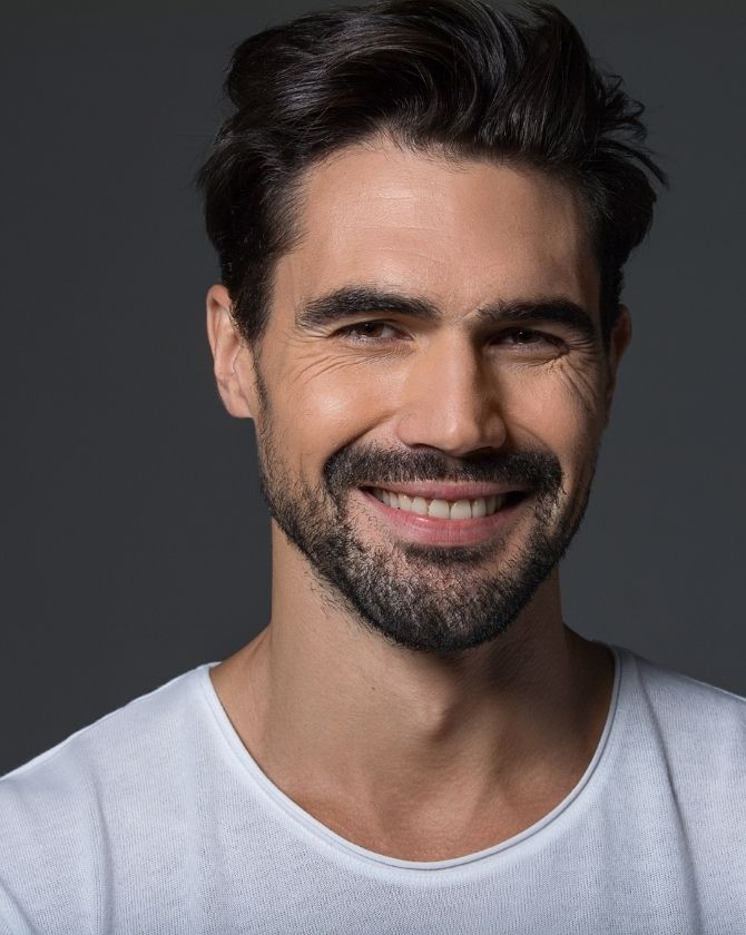 homme calvitie précoce