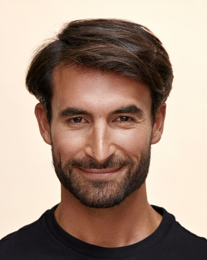 bénéfice microneedling peau