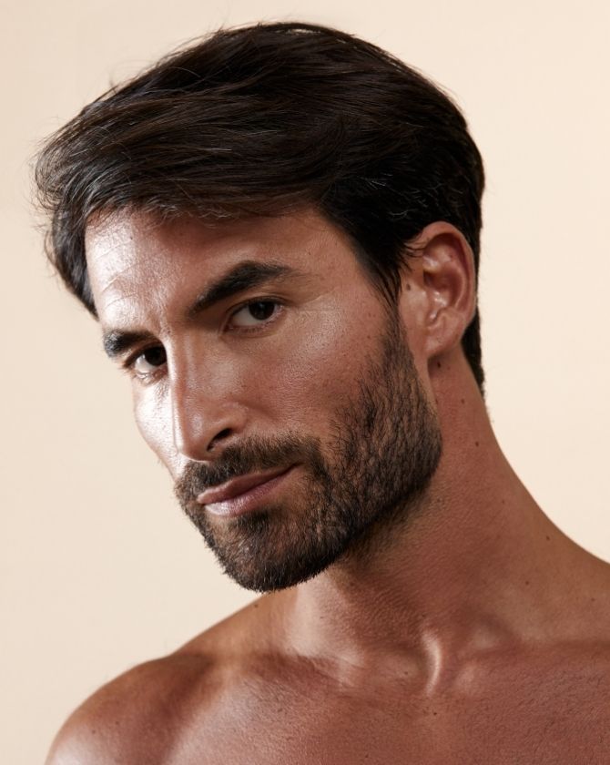 résultat de médecine esthétique sur visage homme