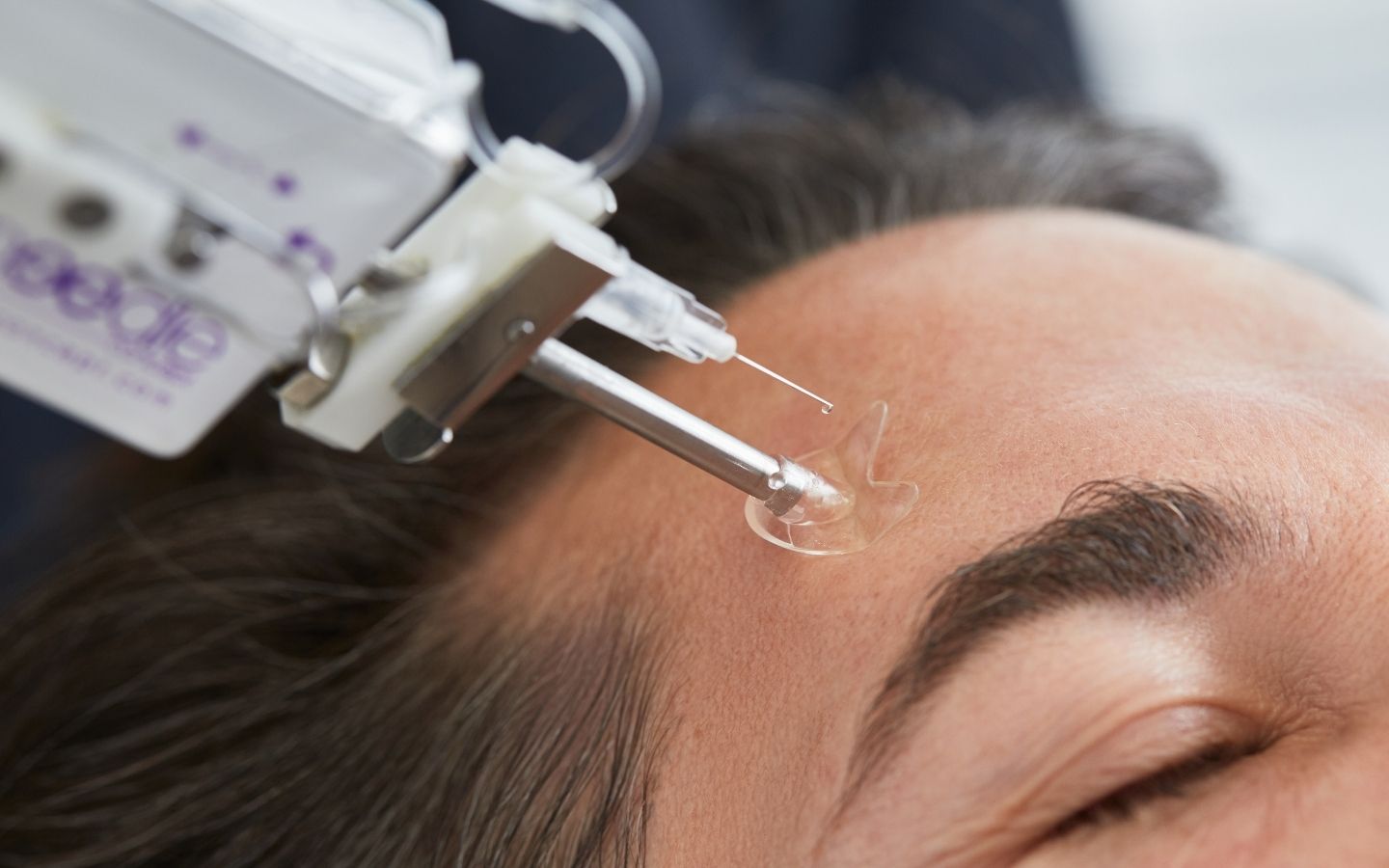 aiguille injection de mésolift du visage à la Maison Lutetia